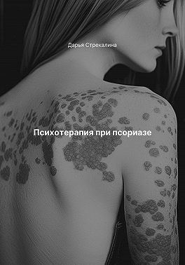 Стрекалина Дарья - Психотерапия при псориазе
