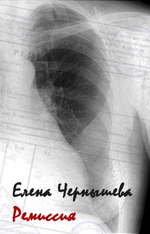 Чернышева Елена - Ремиссия