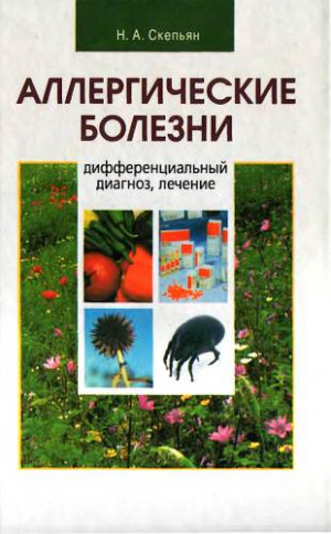 Скепьян Николай - Аллергические болезни: дифференциальный диагноз, лечение