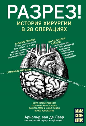 Ван Де Лаар Арнольд - Разрез! История хирургии в 28 операциях