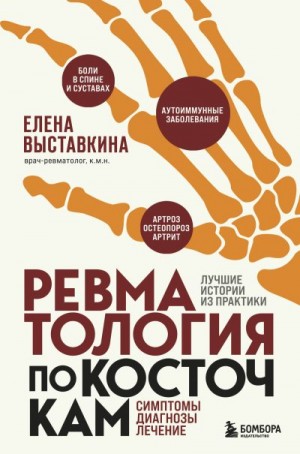 Выставкина Елена - Ревматология по косточкам. Симптомы, диагнозы, лечение