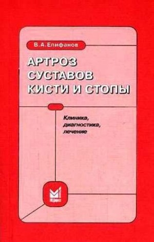 Епифанов Виталий - Артроз суставов кисти и стопы: клиника, диагностика, лечение