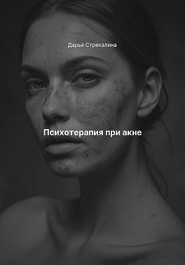 Стрекалина Дарья - Психотерапия при акне